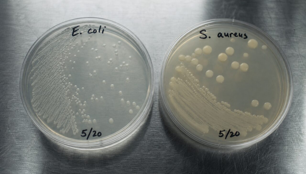 Two labeled petri dishes on a stainless bench, distinct colonies growing, handwritten labels.